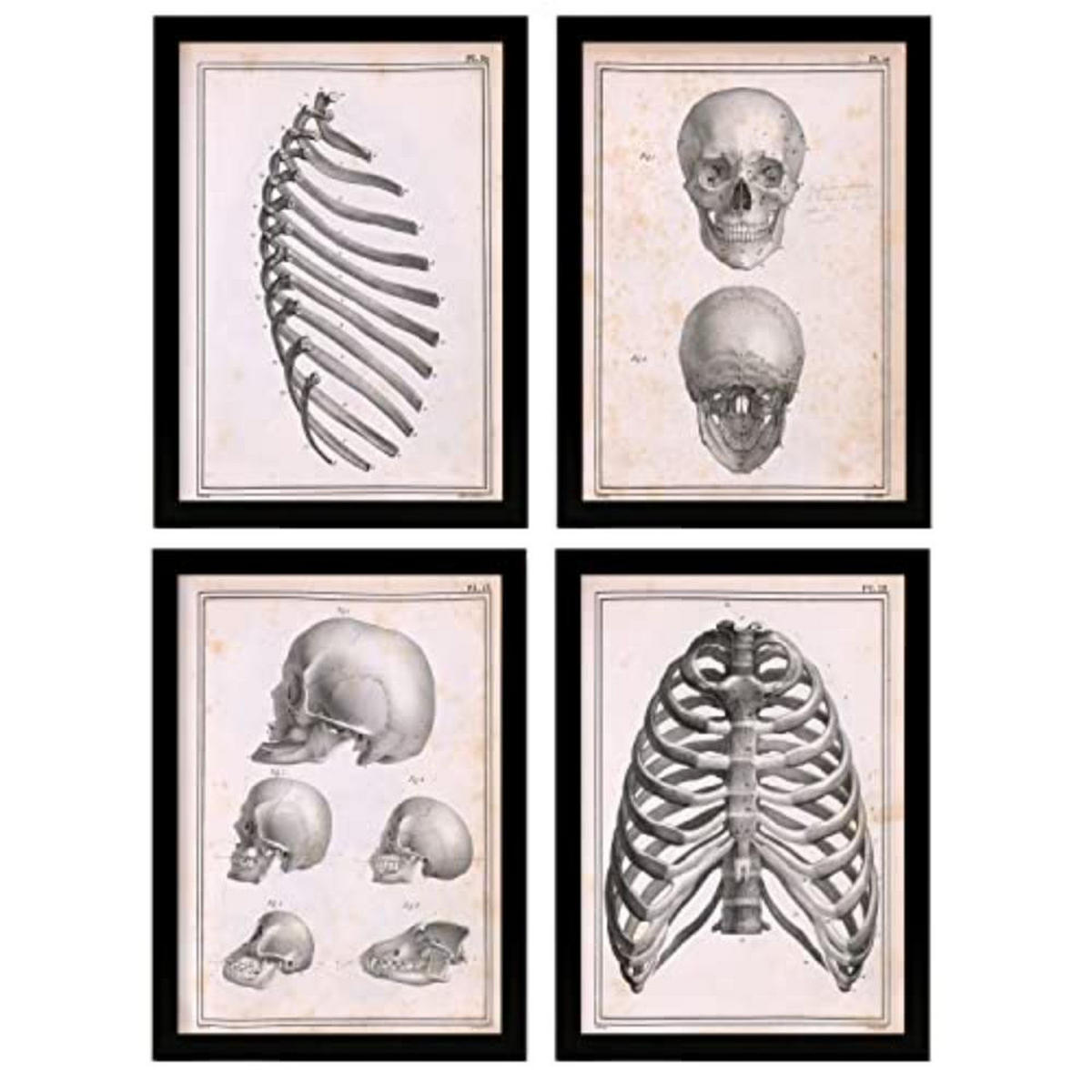 POSTER Set mit 4 Anatomie von Knochen, Rippen und Kopf A4 Schwarzer Rahmen - Schwarz, Papier (29.7/3cm) - Nacnic