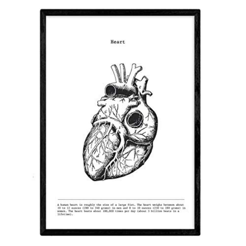 POSTER Anatomie Herz A4 Schwarzer Rahmen - Schwarz, Papier (29.7/5/21cm) - Nacnic
