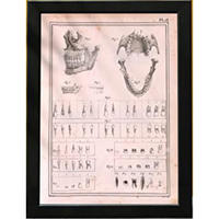 POSTER Medizinische Illustrationen – Kiefer & Zähne A4 Schwarzer Rahmen - Schwarz, Papier (29.7/5/21cm) - Nacnic