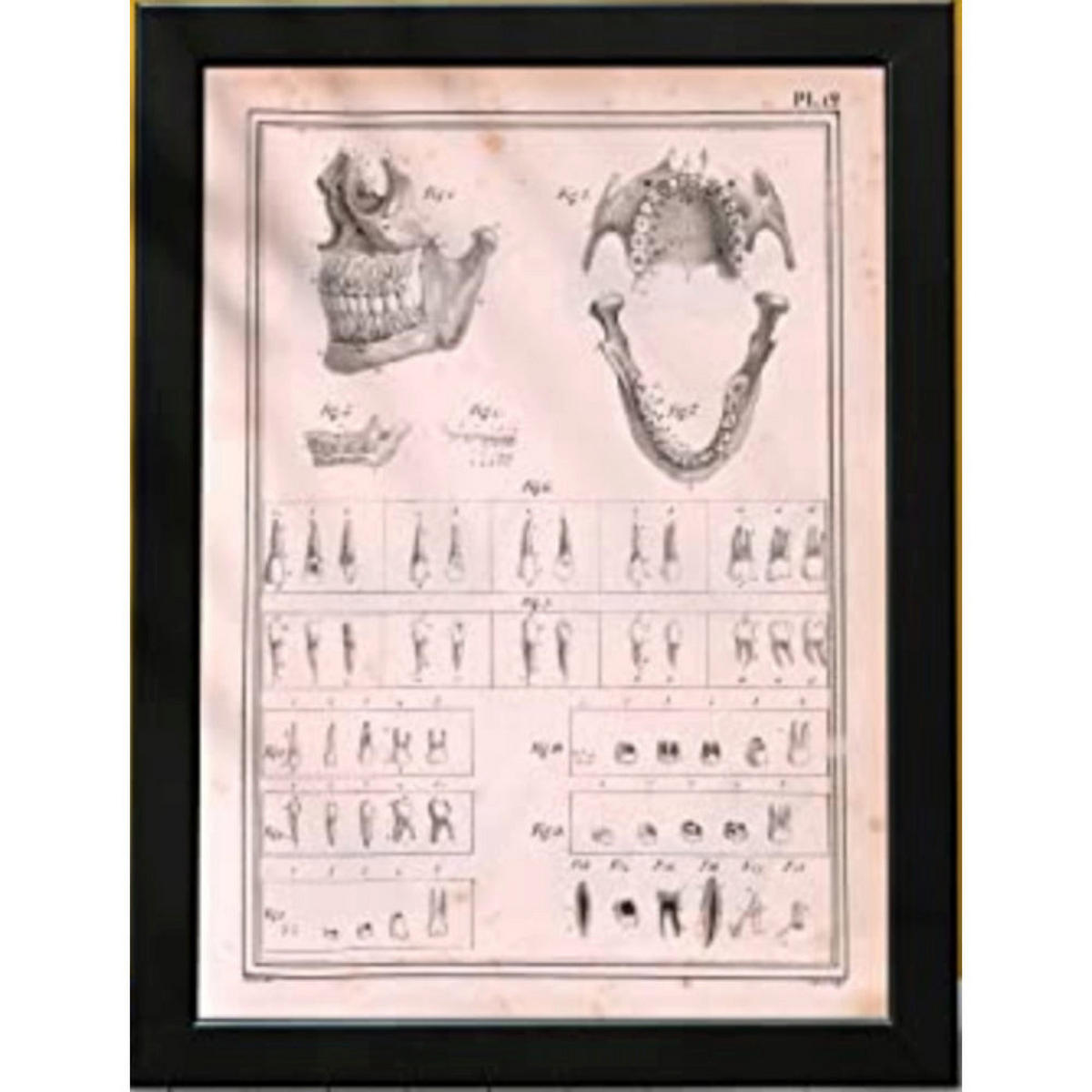 POSTER Medizinische Illustrationen – Kiefer & Zähne A4 Schwarzer Rahmen - Schwarz, Papier (29.7/5/21cm) - Nacnic