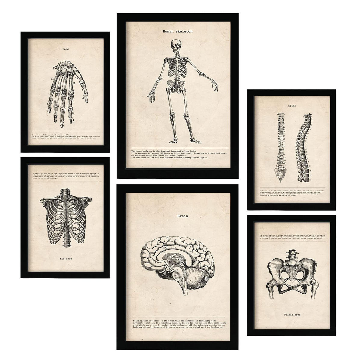POSTER Set Mit 6 Knochenanatomie Größe A3 & A4 Schwarzer Rahmen - Schwarz, Papier (29.7/1cm) - Nacnic
