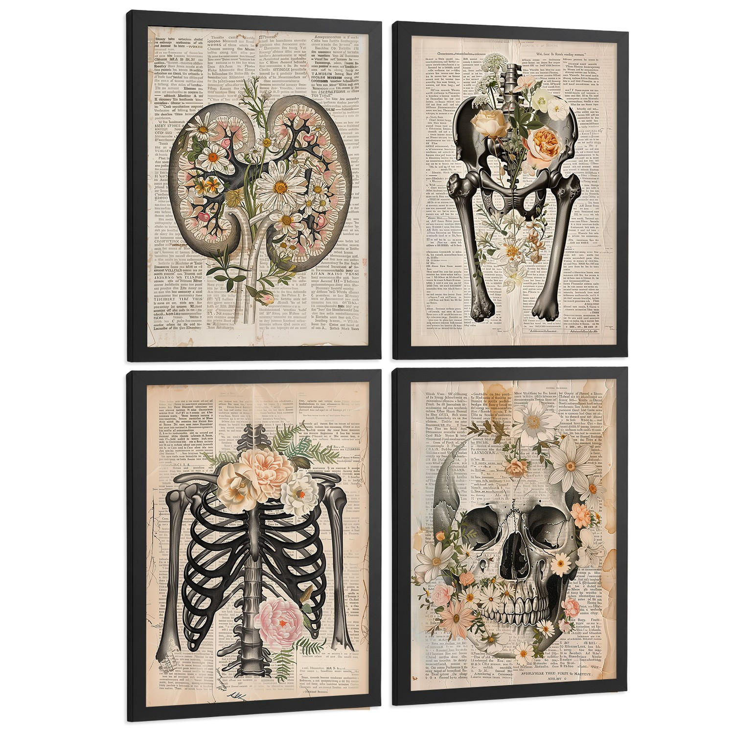POSTER Set aus 4 Anatomie Drucke und Wandbilder mit Nieren Becken Knochen Hüfte Rippen Wirbelsäule Schädel Antiker Buch Stil Größe Schwarzer Rahmen A3 - Schwarz, Papier (29.7/42/3cm) - Nacnic