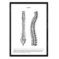 POSTER Anatomie Wirbelsäule A3 Schwarzer Rahmen - Schwarz, Papier (29.7/5/42cm) - Nacnic