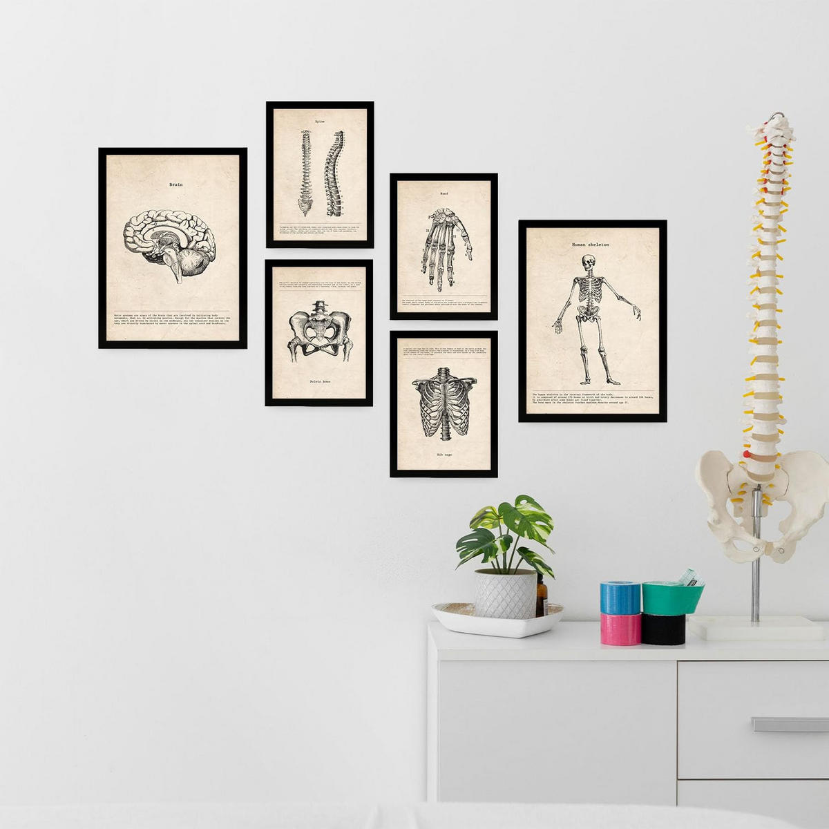 POSTER Set Mit 6 Knochenanatomie Größe A3 & A4 Schwarzer Rahmen - Schwarz, Papier (29.7/1cm) - Nacnic