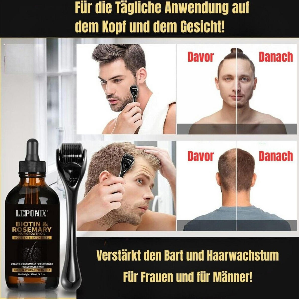 HAARPFLEGE Set mit Rosmarinöl und Kopfhautmassagebürste - Multicolor, Kunststoff (15.5/18.6/6.9cm)