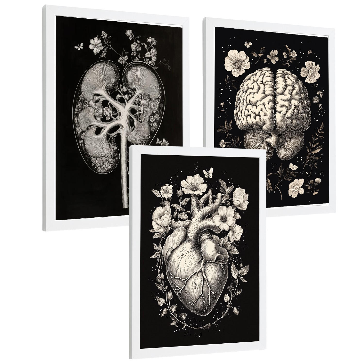POSTER Set aus 3 Anatomie Mensch Drucke und Wandbilder mit Niere Harnsystem Gehirn und Herz Klassisches Schwarz Weiß Design Größe Weißer Rahmen A3 - Weiß, Papier (29.7/42/3cm) - Nacnic