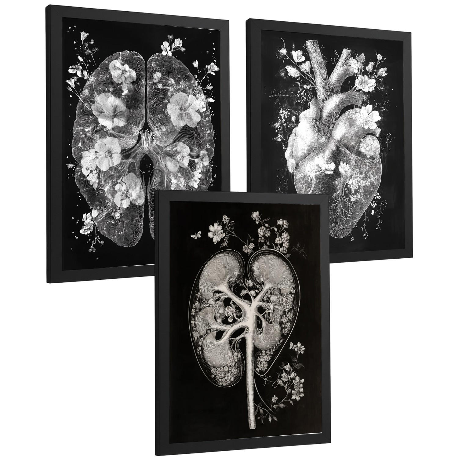 POSTER Set aus 3 Anatomie Drucke und Wandbilder mit Inneren Organen Gehirn Herz Nieren Minimalistisches Schwarz Weiß Design Größe Schwarzer Rahmen A4 - Schwarz, Papier (21/29.7/3cm) - Nacnic