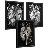POSTER Set aus 3 Anatomie Drucke und Wandbilder mit Inneren Organen Gehirn Herz Nieren Minimalistisches Schwarz Weiß Design Größe Schwarzer Rahmen A3 - Schwarz, Papier (29.7/42/3cm) - Nacnic