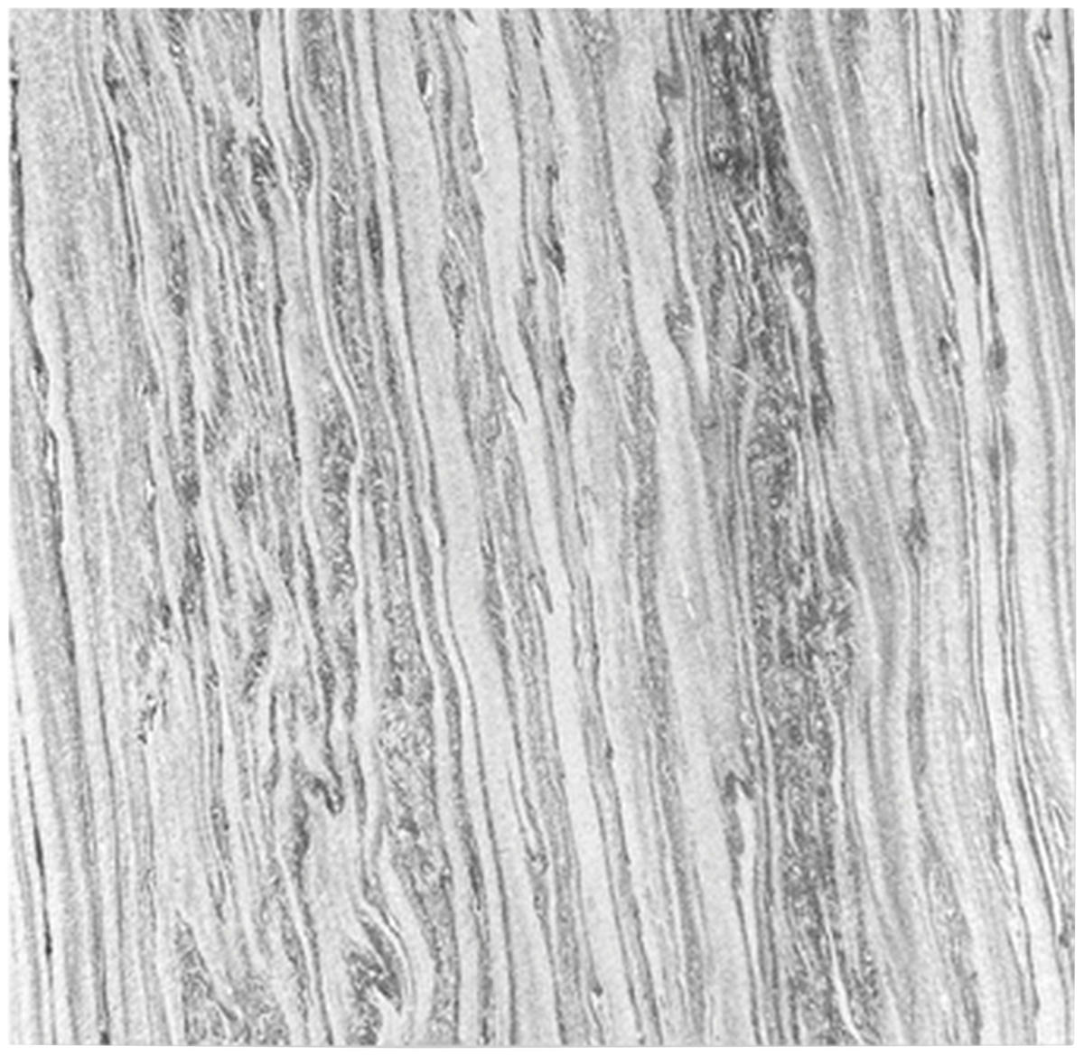 AKUSTICKÝ PANEL velikost: 52/52/0.7 cm - světle šedá, Moderní, textil/kámen (52/52/0.7cm) - Jangal